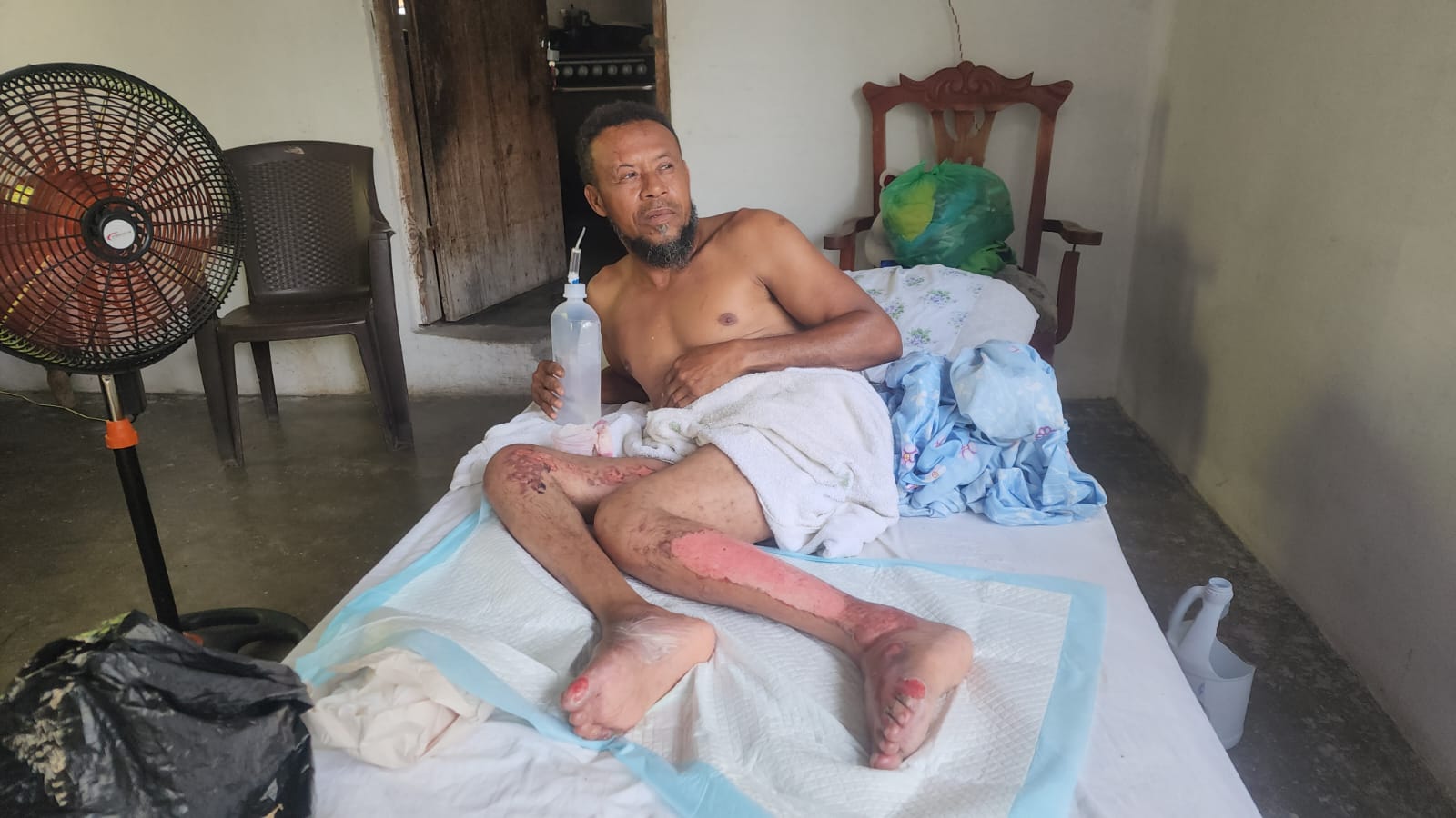 Eddy Reyes González, es un hombre a quien una motocicleta dejó en silla de ruedas, pero, sus limitaciones físicas no impiden que se preocupe por quienes viven en su misma con condición y, por aquellos, que necesitan de sus favores como el ilegal haitiano que atentó contra su vida después de haberlo alojado en su casa y le requiriera marcharse para evitar conflictos con las autoridades migratorias.